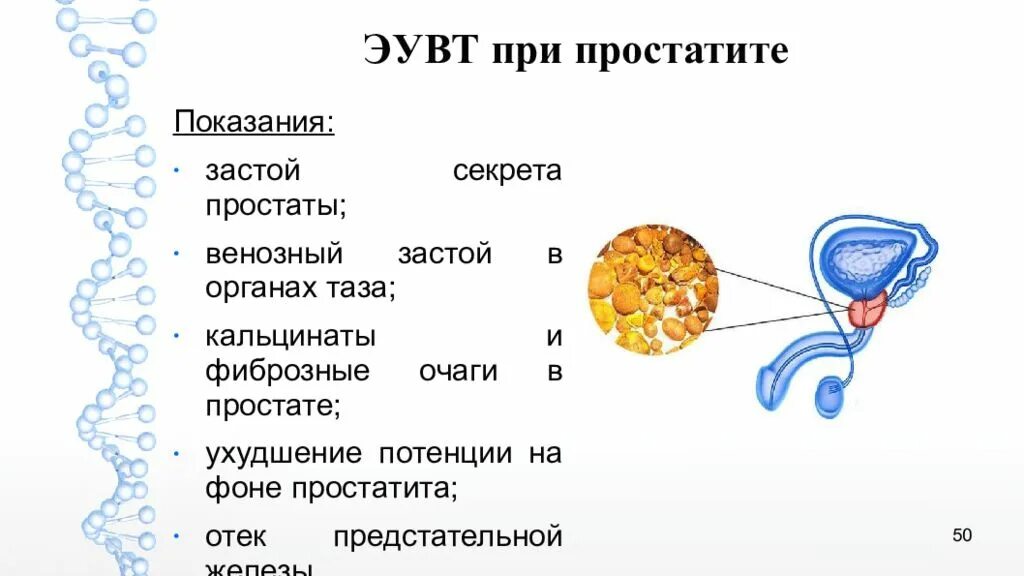 Мочеиспускание после удаления простаты. Застои в предстательной. Застой секрета в предстательной железе.