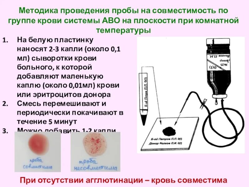 Проведение проб на совместимость крови. Пробы на определение группы крови. Проба на индивидуальную совместимость крови. При проведении пробы на плоскости агглютинация.