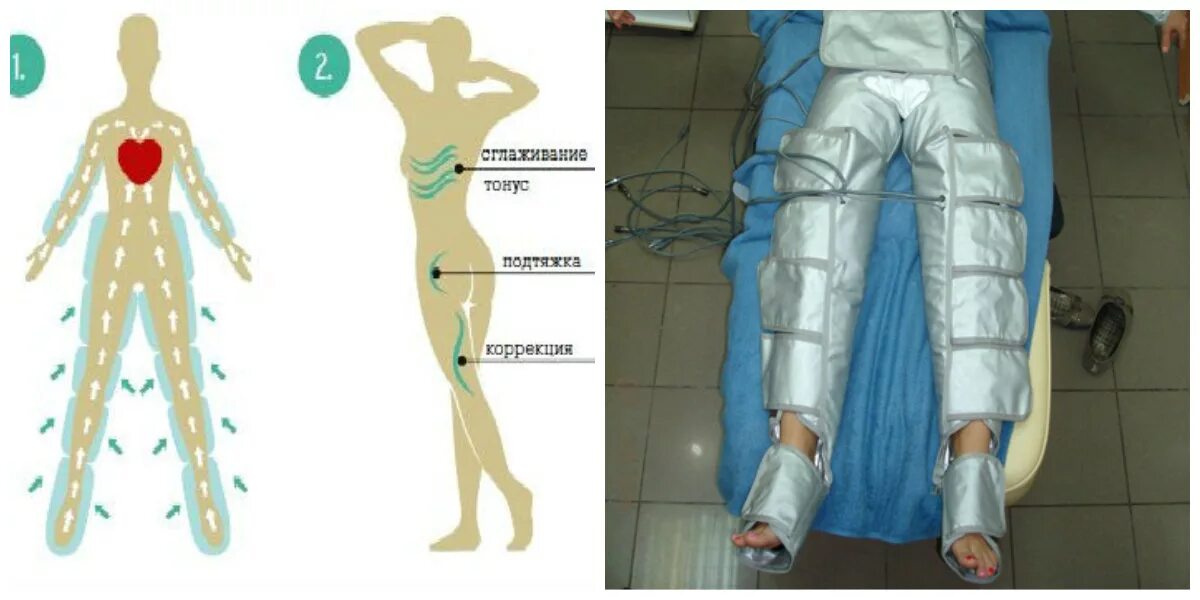 Лимфодренажный массаж для похудения в домашних условиях. Прессотерапия лимфодренаж. Лимфодренажный массаж тела. Лимфодренажный массаж ног. Прессотерапия лимфодренажный массаж.