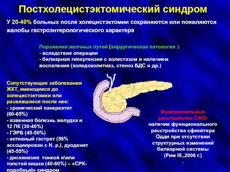 Хронические заболевания поджелудочной. Постхолецистэктомический синдром хронический панкреатит. Хронический панкреатит язвенная болезнь желудка. Панкреатит после холецистэктомии.