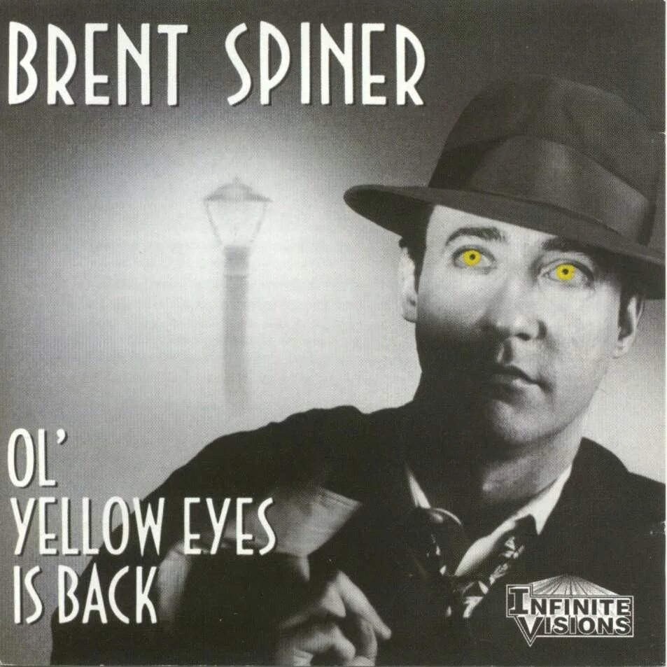 His eyes are yellow. His eyes are yellow. Глаза мужские. Желтые белки синдром жильбера. Серо желтые глаза.