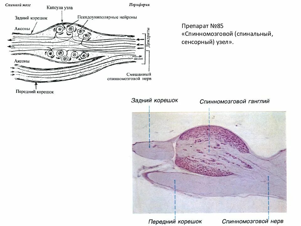 Строение нервного узла. Спинномозговой ганглий гистологический препарат. Спинномозговой узел гистология схема. Спинальный ганглий гематоксилин эозин. Спинномозговой узел гистология препарат с подписями.