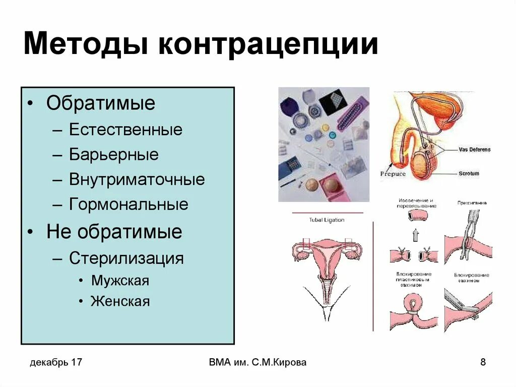 Виды контрацептивов. Методы контрацепции. Современные принципы и методы контрацепции. Метод контрацептивы. Контрацепции методы контрацепции.