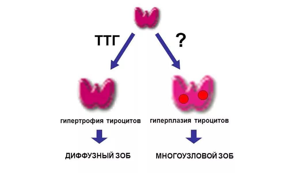 Диффузный нетоксичный. Многоузловой токсический зоб патогенез. Узловой токсический зоб этиология. Многоузловой нетоксический зоб( v - 22.6 мл). Диффузного эутиреоидного зоба.