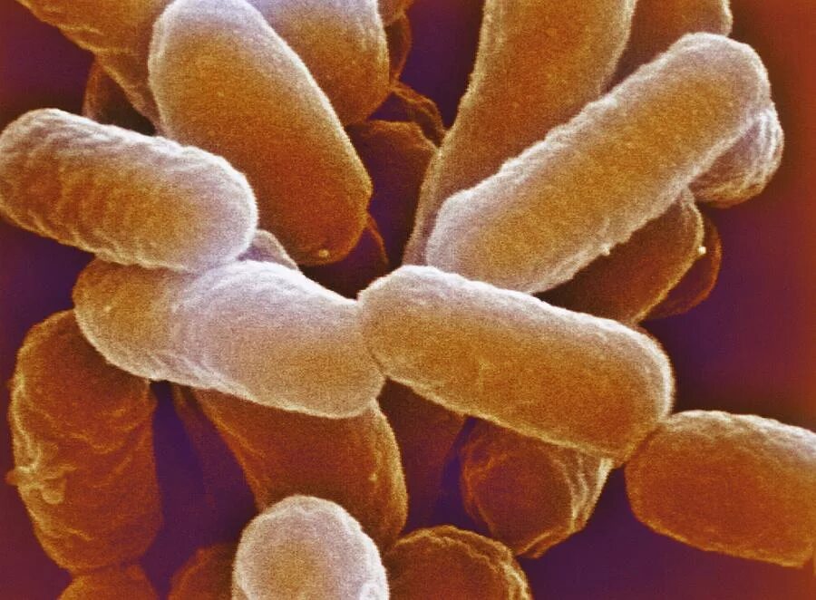Mycoplasma mycoides jcvi-syn1. Синтетическая бактериальная клетка синтия. Синтетическая бактериальная клетка синтия. Микоплазма микоидес. Клетка человека.