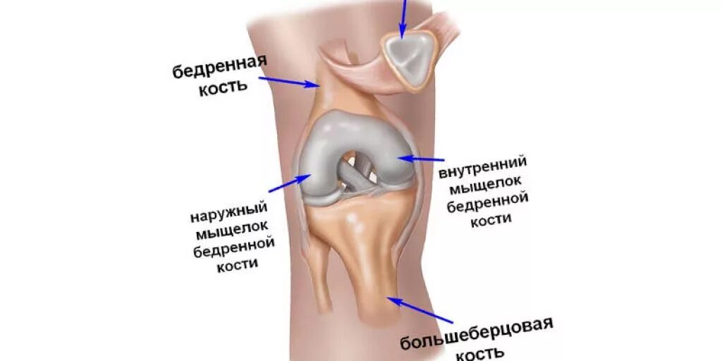 Мыщелок бедренной. Что такое жировая клетчатка Гоффа коленного сустава. Импиджмент клетчатки Гоффа. Клетчатка Гоффа коленного сустава. Жировые тела коленного сустава.