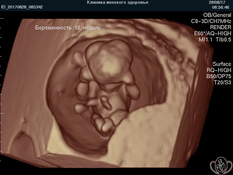 УЗИ 12 недель. УЗИ беременных 12 недель. 3д УЗИ на 12 неделе беременности. Снимки УЗИ на 12 неделе. Беременность 12 4 недели