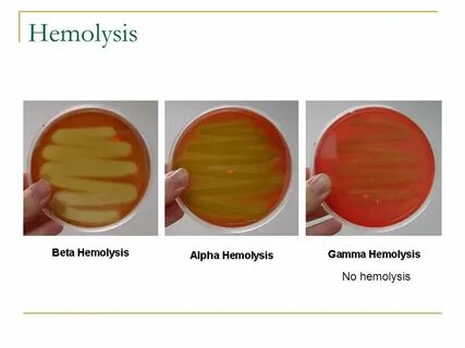 Объясните значение тэ haemolysis