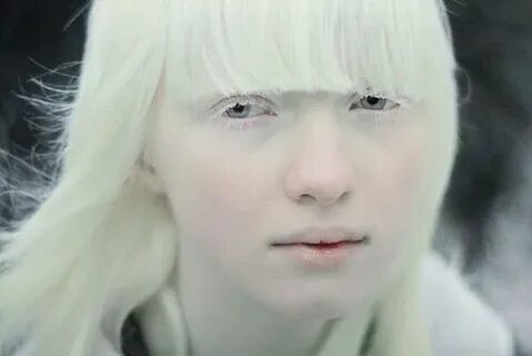 Элден ринг альбиносы