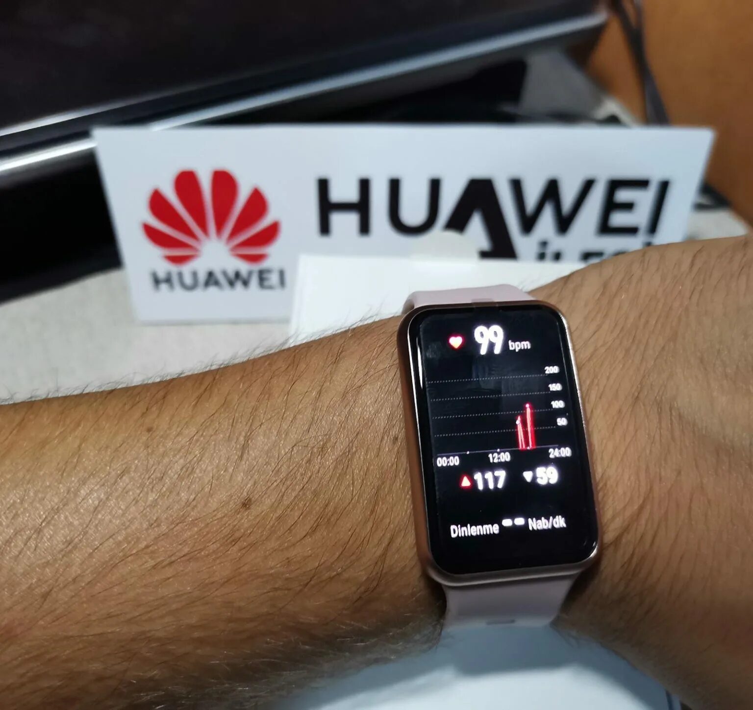 Хуавей вотч фит 2 циферблаты. Хуавей Бен 6. Циферблаты Huawei Fit 2. Циферблаты для Хуавей фит 2. Установить часы huawei band