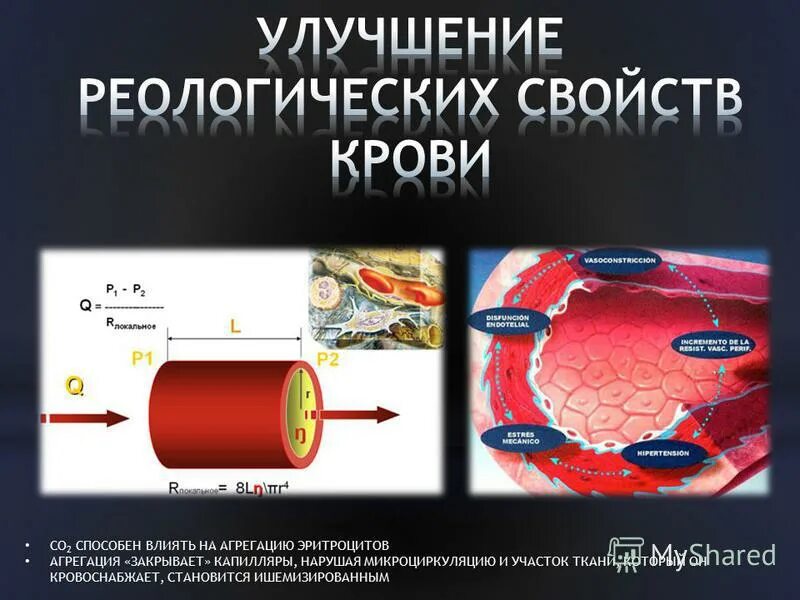 Сосуды вены артерии венулы артериолы капилляры. Сосуды сфинктеры это физиология. Закрытые капилляры. Схема строения микроциркуляторного кровеносного русла. Микроциркуляция картинки.