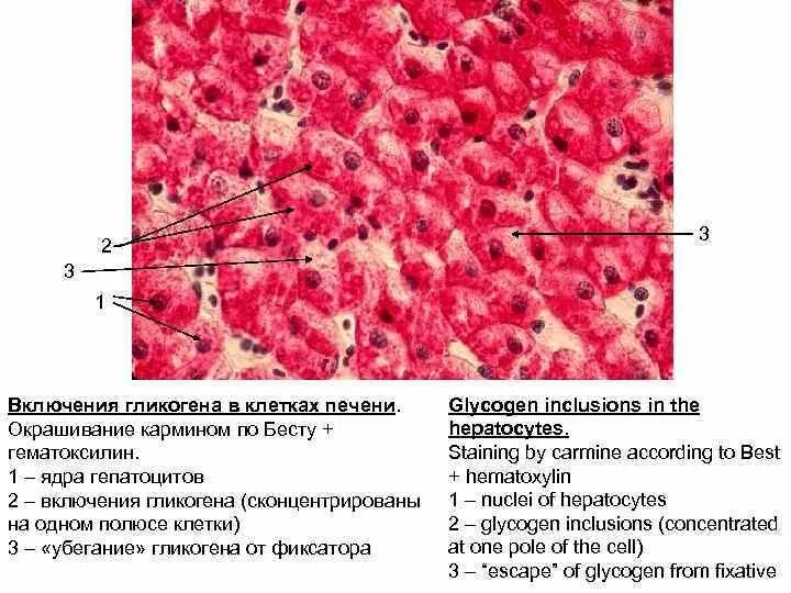 В клетках печени происходит. Включения гликогена в печени аксолотля. Включения гликогена в клетках печени окраска кармином по Бесту. Включения гликогена окраска кармином. Включения гликогена в клетках печени.