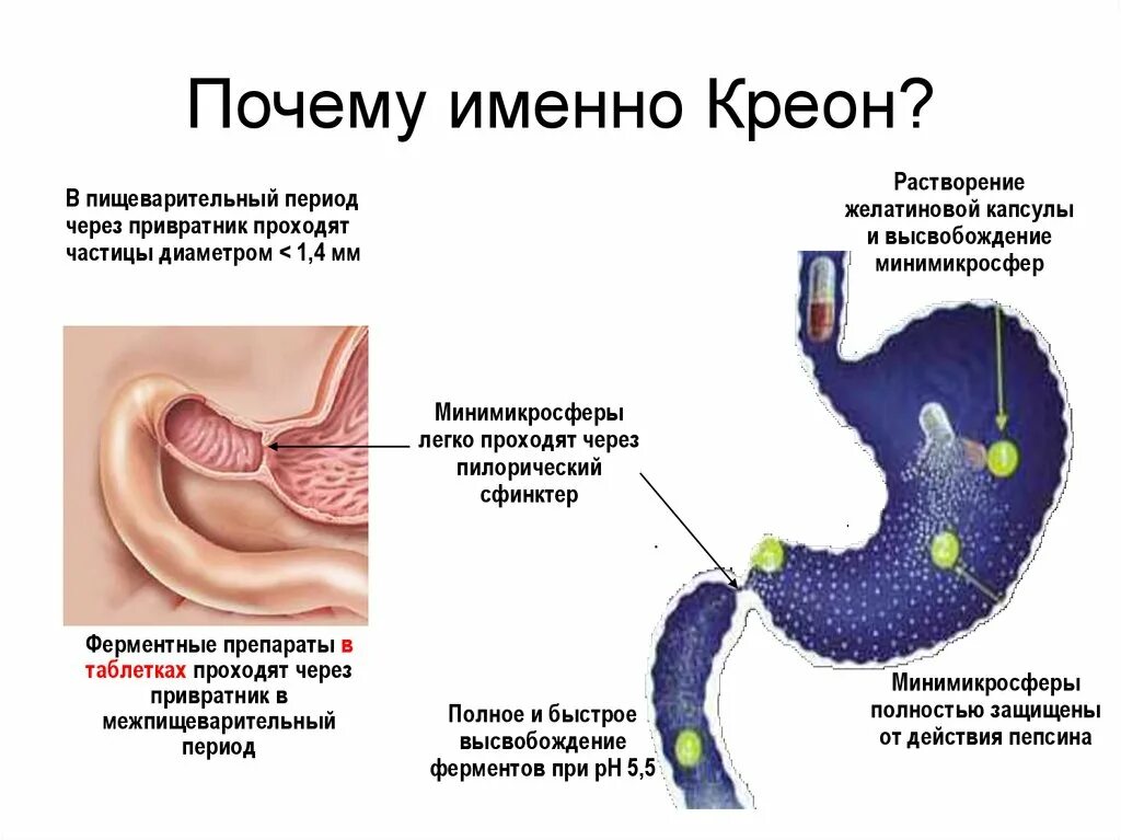 Язва привратника желудка. Сфинктер недостаточность кардии желудка. Недостаток кардии