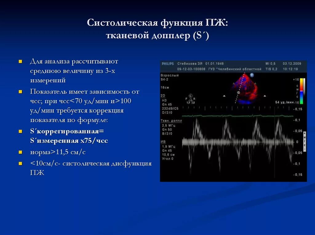 Что определяет доплер. Тканевой импульсно-волновой допплер. ЭХОКГ норма тканевая допплерография. ЭХОКГ импульсно волновая тканевая допплерография. Тканевой допплер в клинической эхокардиографии.