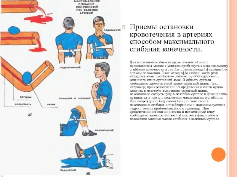 Остановка кровотечения методом предельного сгибания. Остановка кровотечения методом сгибания конечностей. Временная остановка наружного кровотечения из локтевой артерии. Остановка кровотечения методом максимального сгибания конечности. Повреждение мелких артерий кистей и стоп