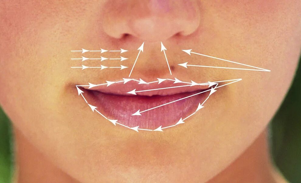 Складки углы рта. Методика введения филлера в губы. Коррекция губ. Техника введения филлера в губы.