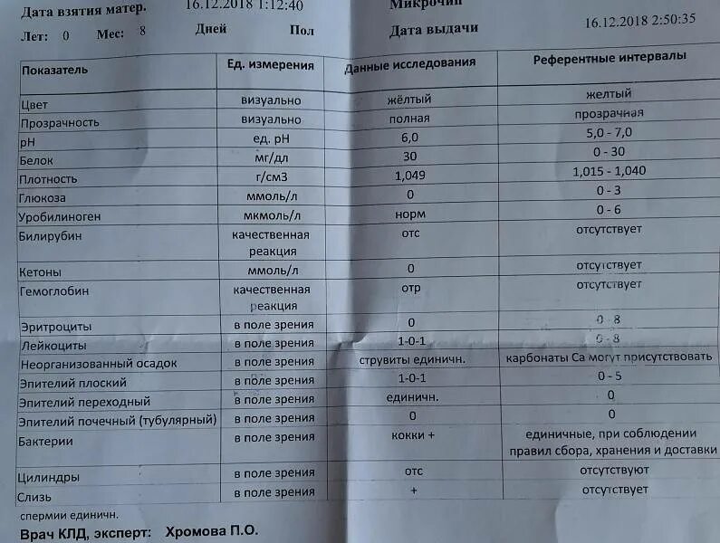 Эпителий плоский в моче норма. Нормальные показатели анализа мочи эпителий. ОАМ эпителий плоский норма у детей. Эпителий плоский в моче у ребенка норма. Повышенный эпителий в моче у мужчин