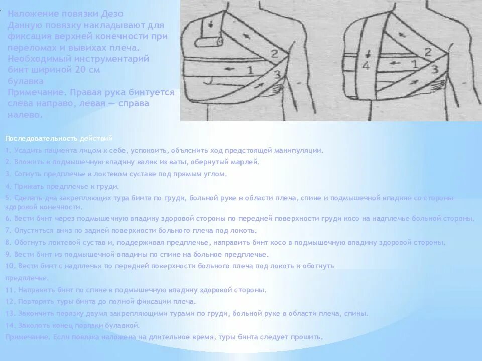 Дезо инструкция. Наложение повязки Дезо. Повязка Дезо при вывихе плеча. Схема наложения повязки Дезо. Повязка Дезо алгоритм.