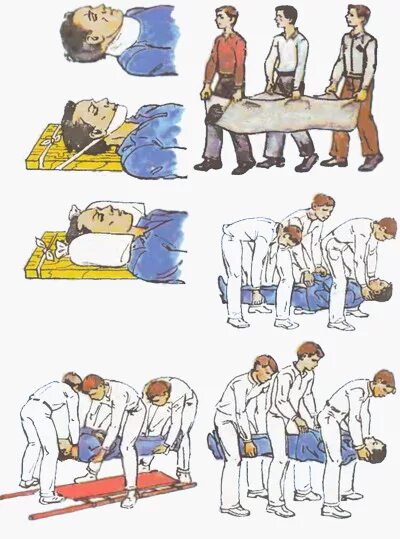 Транспортировка пациента при травме позвоночника. Транспортировка больного с переломом позвоночника. Транспортировка больного с травмой позвоночника. Транспортировка при переломе позвон. Перевозка больных с переломом позвоночника.