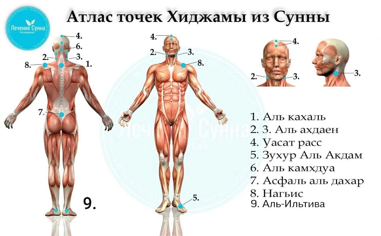 Хиджама от чего помогает женщинам. Схема хиджама точки. Хиджама кровопускание точки. Хиджама точки по Сунне атлас. Хиджама атлас точек для женщин.