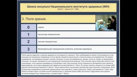 Ламс при инсульте
