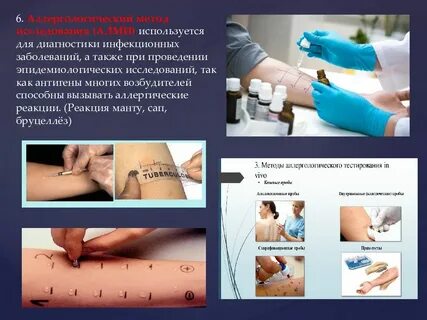 Анализ кожные пробы