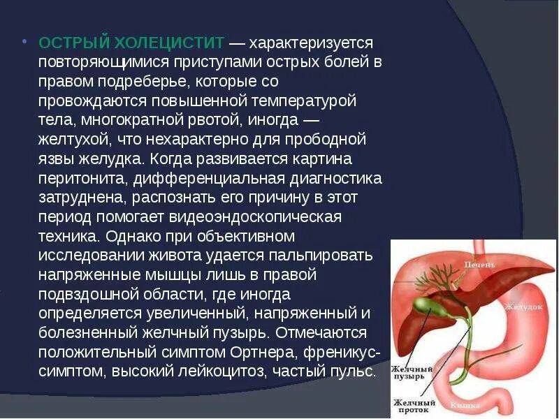 Воспаление желчного пузыря симптомы. Жёлчный пузырь болит симптомы. Желчный пузырь при остром холецистите.