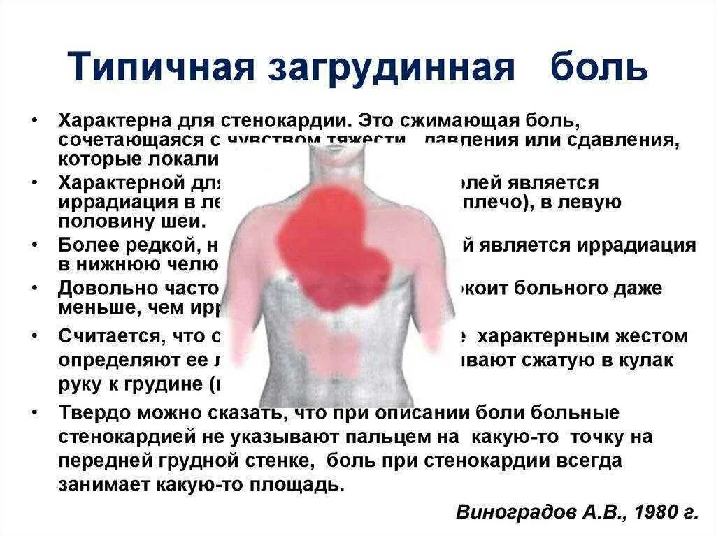 Иррадиация стенокардии. Боли в центре под грудной клеткой спереди. Боль в центре грудной клетки спереди при движении. Болит в грудине посередине. Резь в грудной клетке посередине.