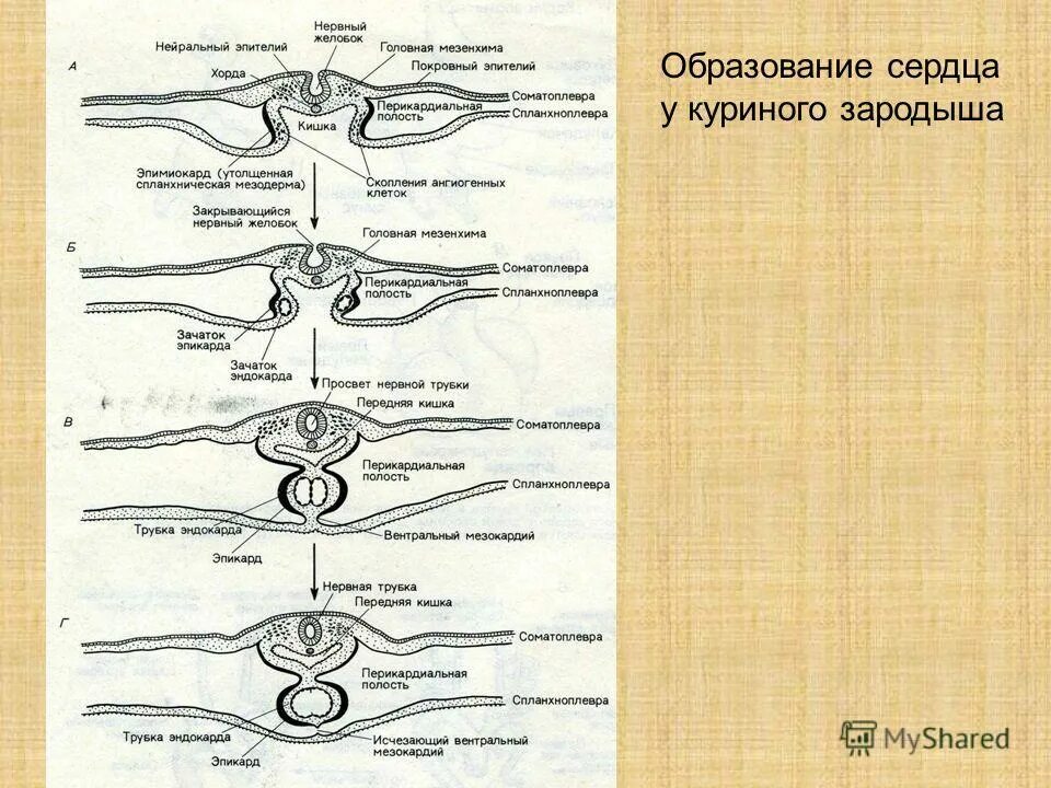 новообразования сердца. образование сердца. миксома левого желудочка кт. образование сердца. анатомия клапанов сердца сосочковые мышцы.