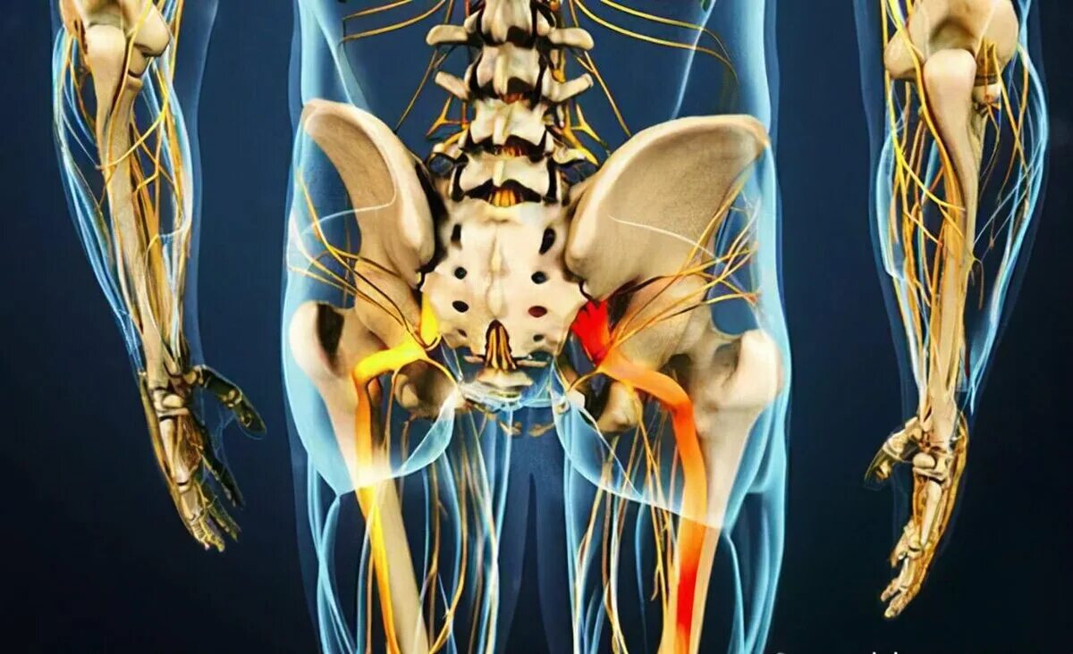 Ишиас - защемление седалищного нерва. Седалищный нерв (sciatic nerve)? 011. Защемление седалищного нерва анатомия. Седалищный нерв анатомия таз.