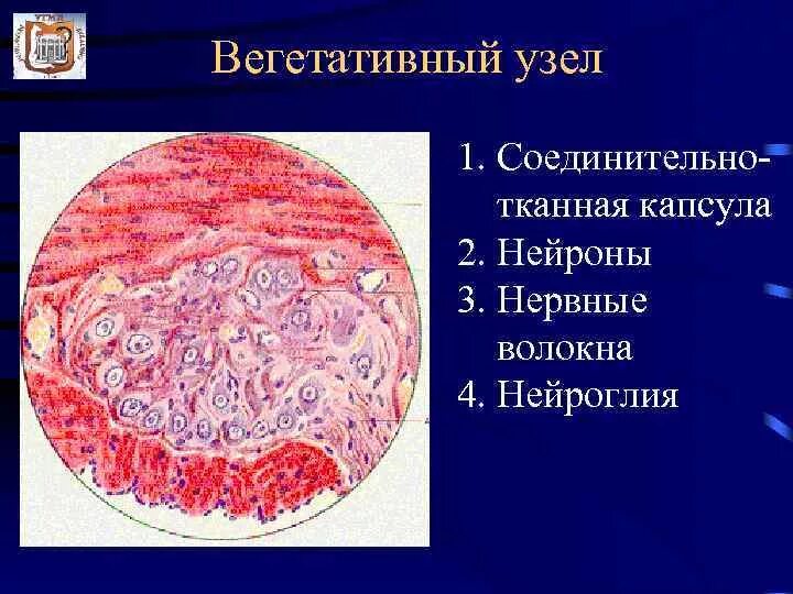 Строение нервного узла. Спинномозговой ганглий гистология. Вегетативный нервный узел препарат. Вегетативный нервный узел гистология препарат. Вегетативный ганглий препарат.