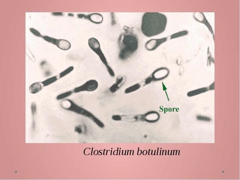 Клостридии ботулизма ( Clostridium botulinum ) ботулизм. Клостридии возбудители ботулизма.