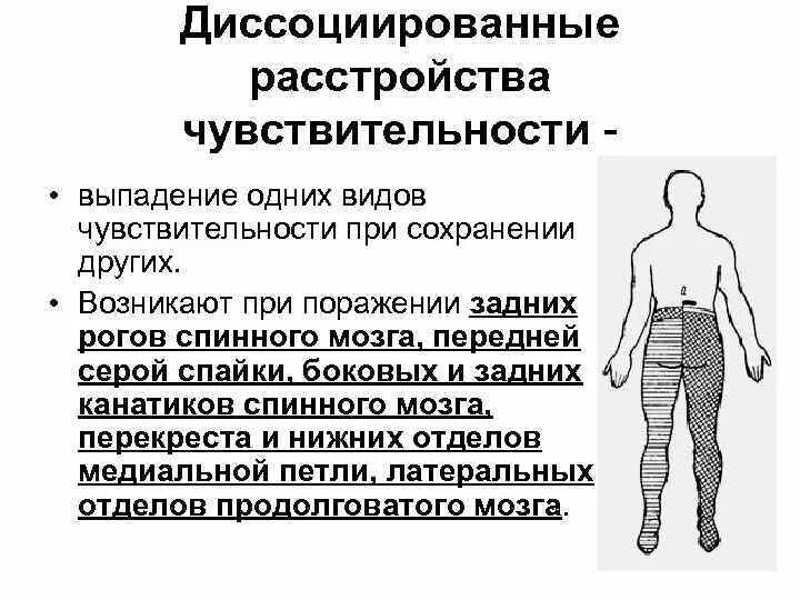 Типы поражения чувствительности. Диссоциированные расстройства чувствительности. Диссоциированный Тип расстройства чувствительности. Нарушение чувствительности схема. Сегментарный диссоциированный Тип нарушения чувствительности.