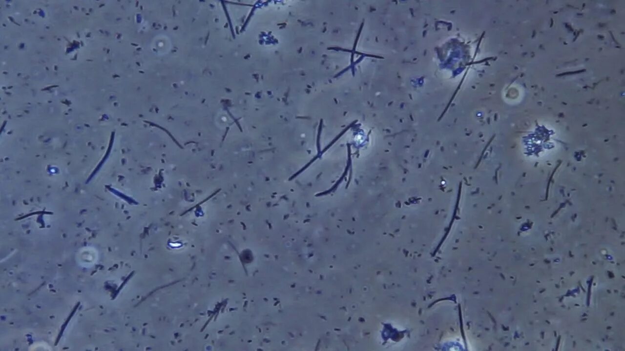 Микрофлора зубного налета под микроскопом. Бактерии на зубном налете микроскоп. Бактерии зубного налета под микроскопом. Бактерии ротовой полости под микроскопом. Бактерии в слюне