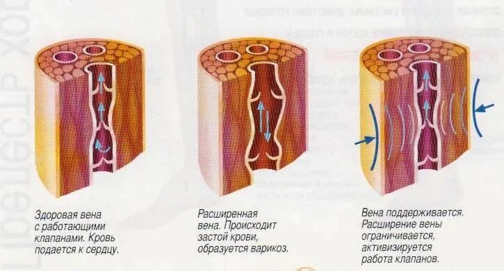 Застой вен. Застой вен