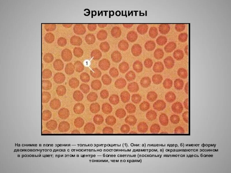 Изменение свойств эритроцитов при тропической малярии. Эритроциты под микроскопом. Эритроцит окрашивается. Эритроциты в поле зрения. Тени эритроцитов при малярии.