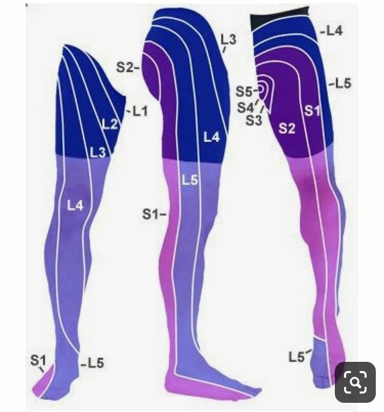 Радикулопатия l5 s1. Дерматом l4-l5. Дерматом l5 s1. Иннервация l4-l5. Дерматомы l5-s1.