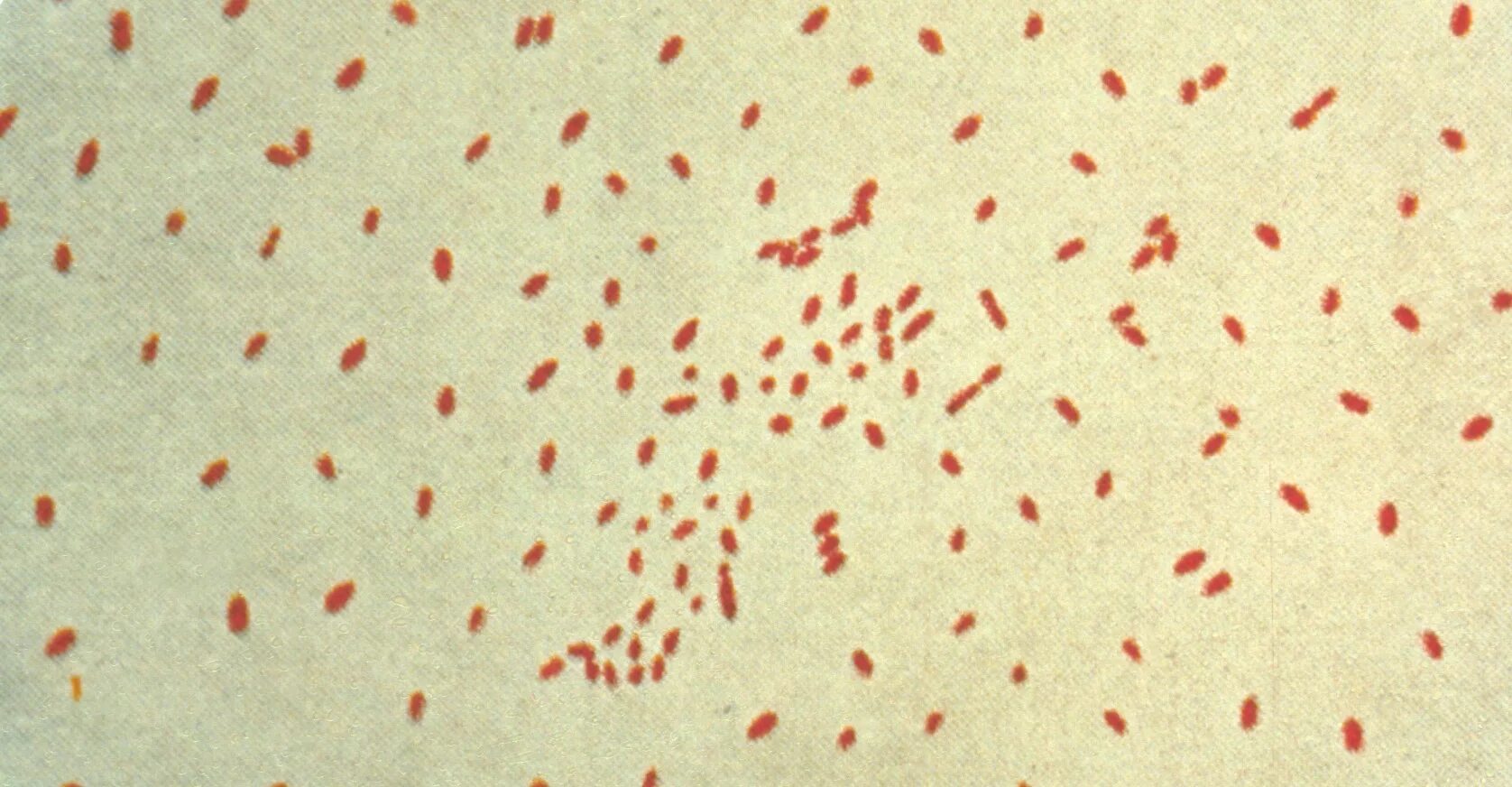 Pertussis коклюш. Бордетеллы коклюша морфология. Бордетелла пертуссис. Возбудитель коклюша Bordetella pertussis. Бордетеллы коклюша микроскопия.