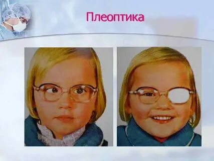Плеоптика