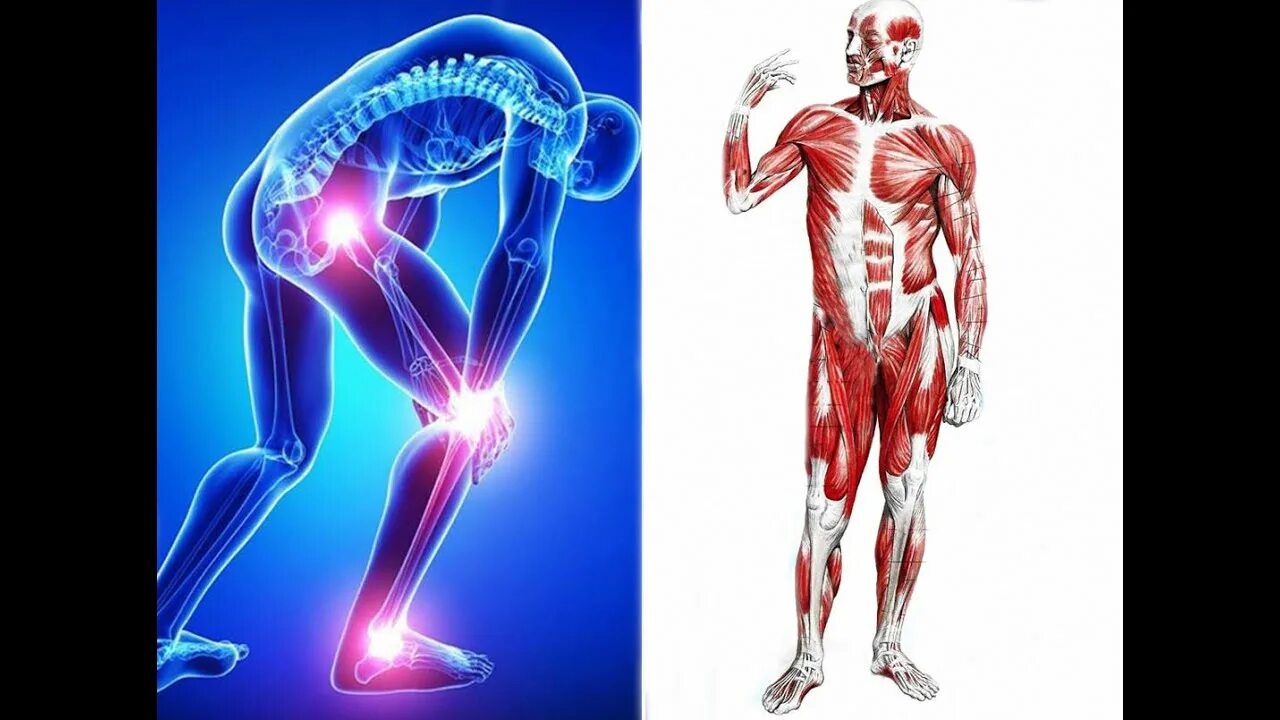 Мышцы и суставы. Мышцы и суставы человека. Мышечные и суставные боли. Суставные и мышечные боли рисунок.