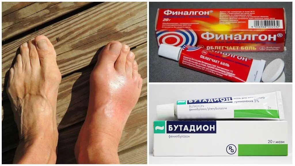 Как вылечить стоп