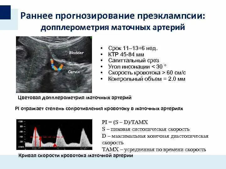 Кровоток в маточных артериях норма при беременности. УЗИ допплерометрия маточных артерий. Кровоток в маточных артериях норма. Допплерометрия пи в маточных артериях норма. Нормы маточных артерий по неделям