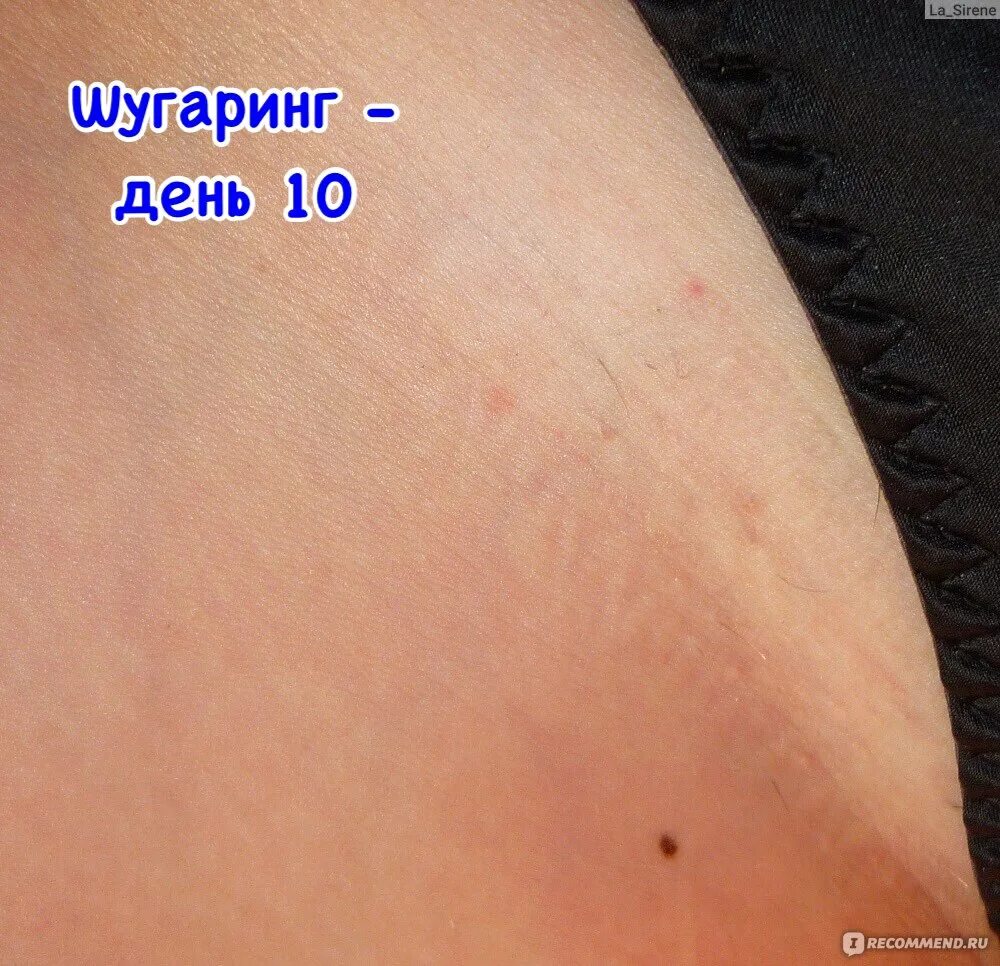 Зона глубокого бикини схема. Сахарная депиляция глубокое бикини. Эпиляция зоны глубокого бикини. Депиляция линии бикини. Бикини самой себе.