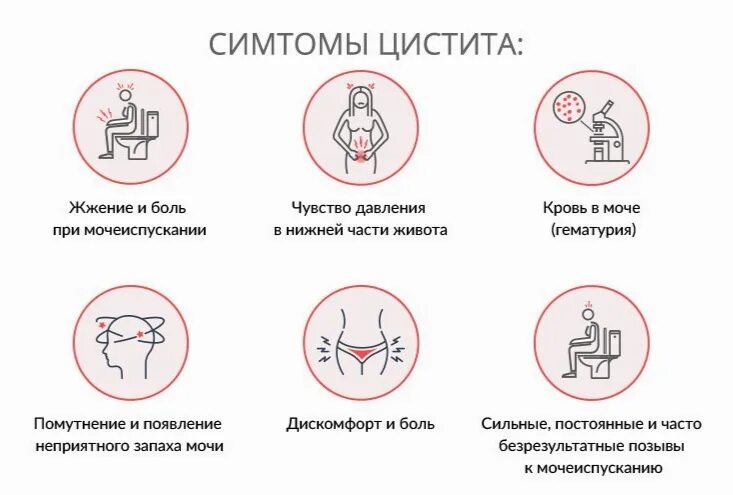 Цистит повторяется. Симптомы при цистите. Цистит симптомы и профилактика. Симптомы цистицистита.