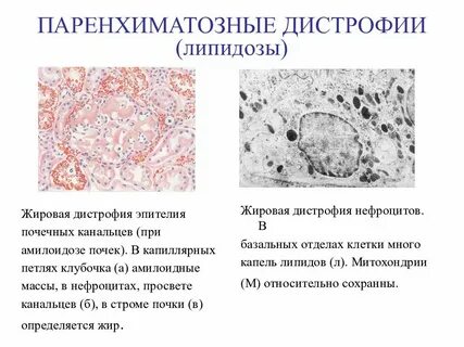 Жировая почка