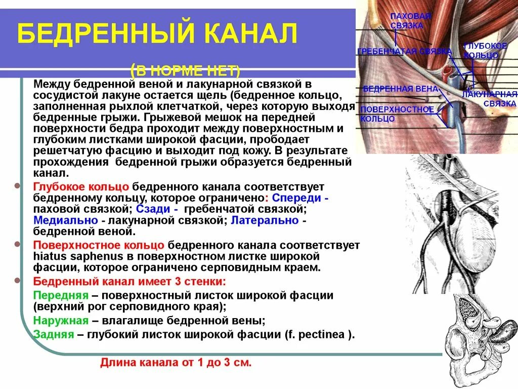 Ущемленная бедренная грыжа. Бедренная грыжа операции топографическая анатомия. Бедренная грыжа содержимое мешка. Бедренные грыжи Госпитальная хирургия.