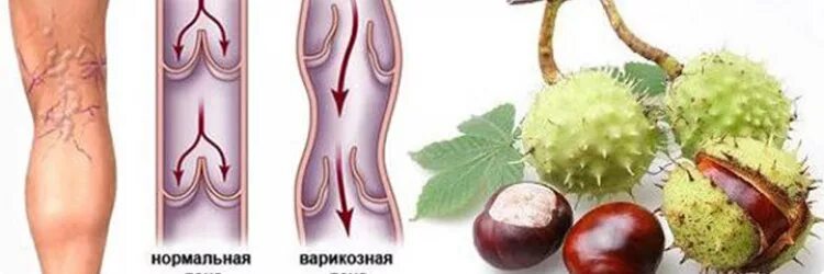 крем от варикоза ног с конским каштаном. каштан для вен. конский каштан эскузан. крем для ног с конским каштаном. бальзам с экстрактом конского каштана.