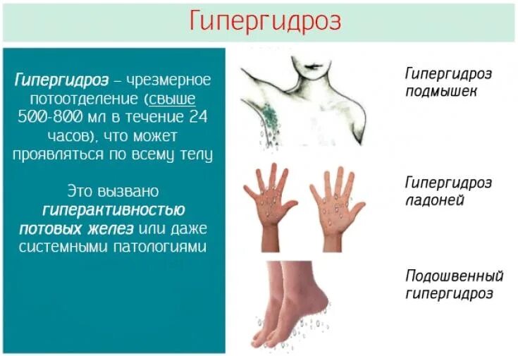 Изжога реклама. Как предотвратить сердечный приступ. Повышенная потливость что это. Потливость. Потные подмышки.