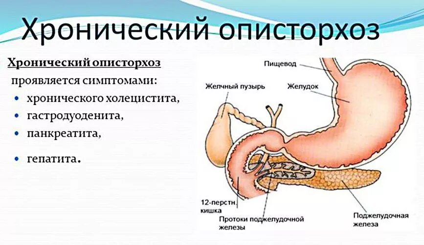 Описторхоз определение. Описторхоз желчные протоки. патогенез хронического описторхоза. описторхоз размер и форма паразитирует в органах.