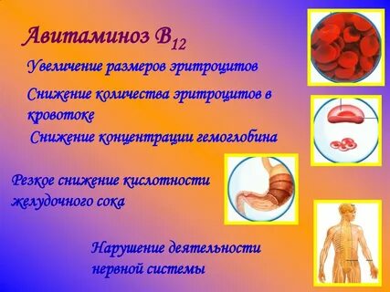 Витаминоз